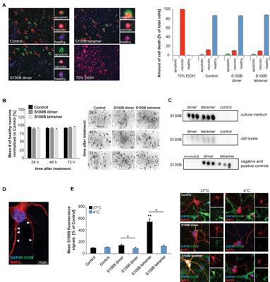 Zinc Binding to S100B Affords Regulation of Trace Metal Homeostasis and Excitotoxicity in the Brain